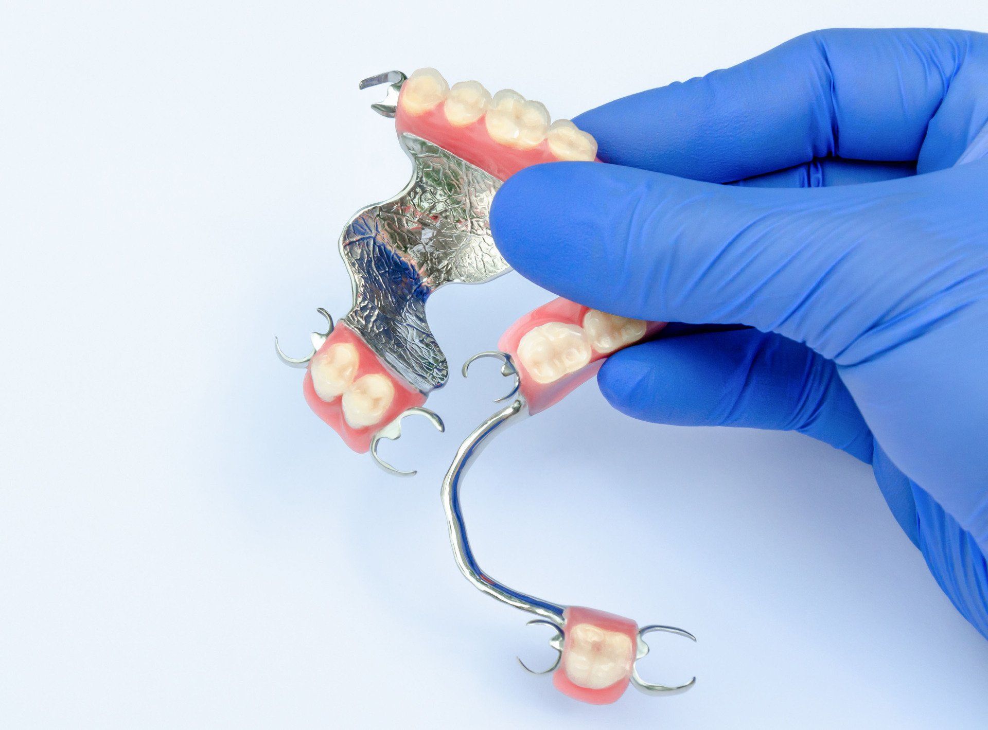 Partial metal dentures