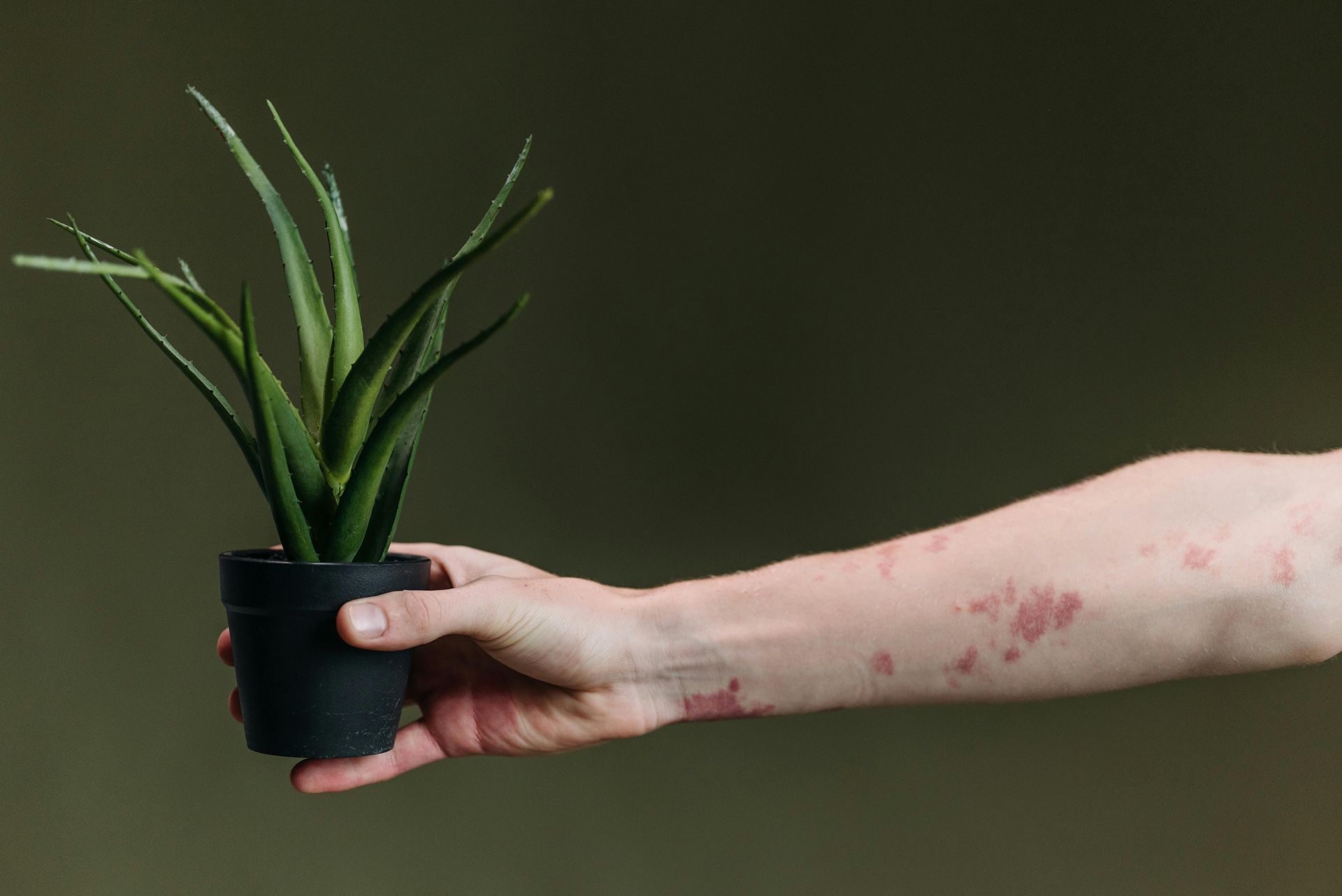 A person with a rash on their arm is holding a potted plant.