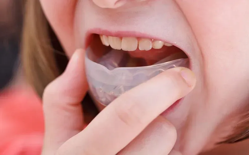 Mouth Guards