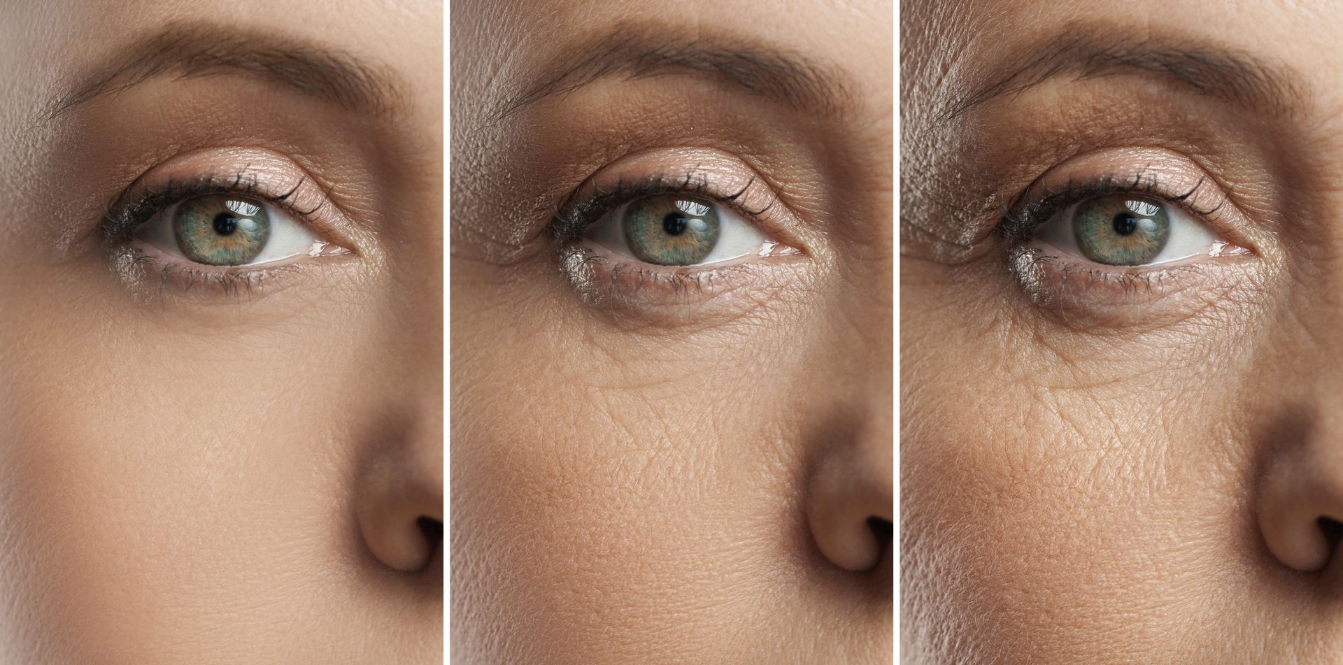 Three close-up panels of an eye and cheek area showing a progression of increasing skin texture and visible fine lines.
