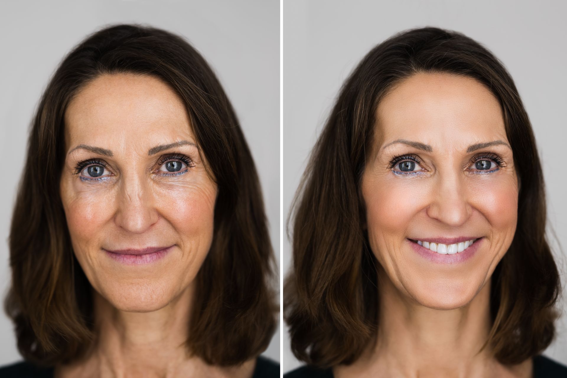 Side-by-side portraits of a woman, left with a neutral expression and right smiling, on a white background