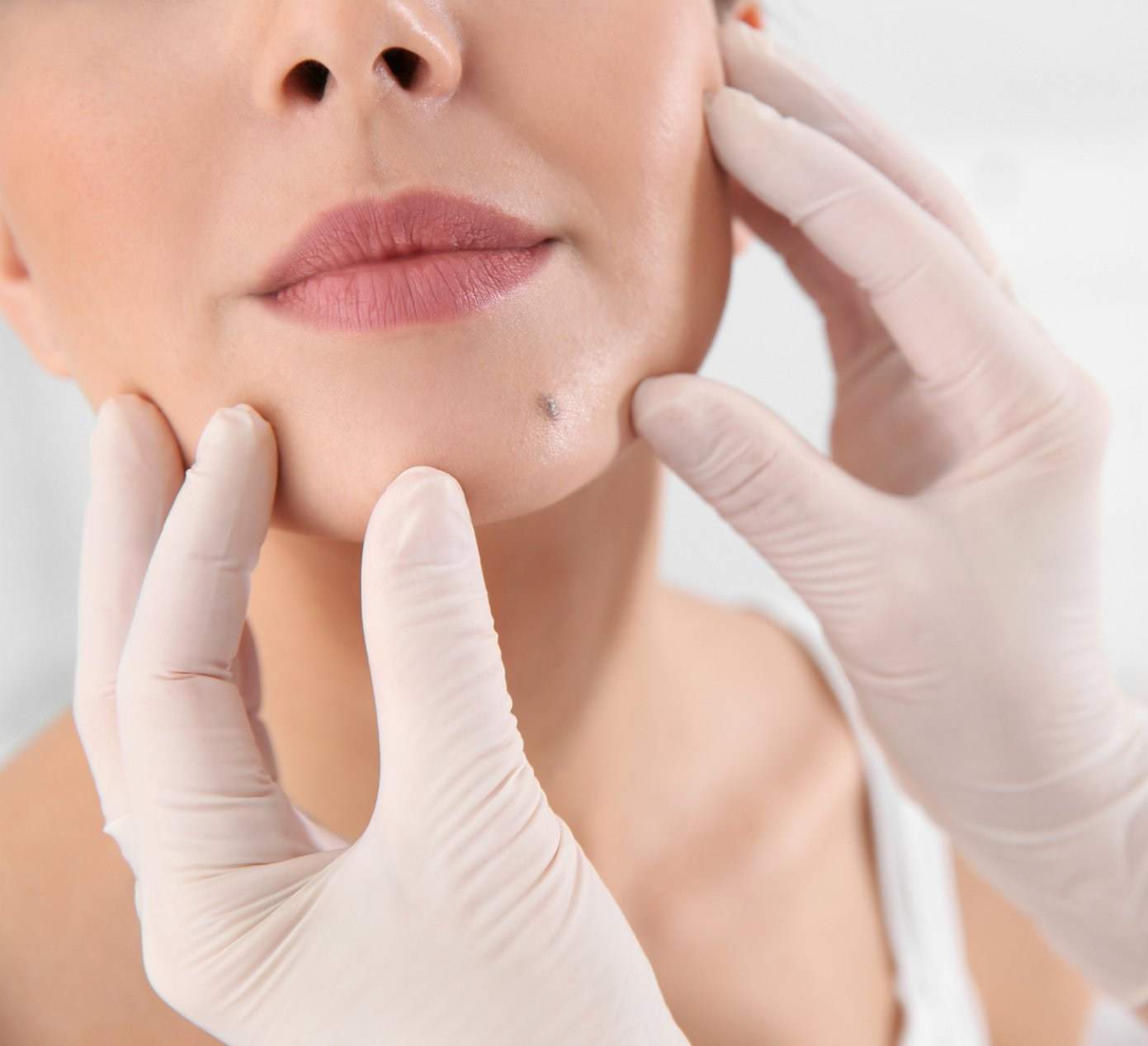 doctor examining mole on face of female patient