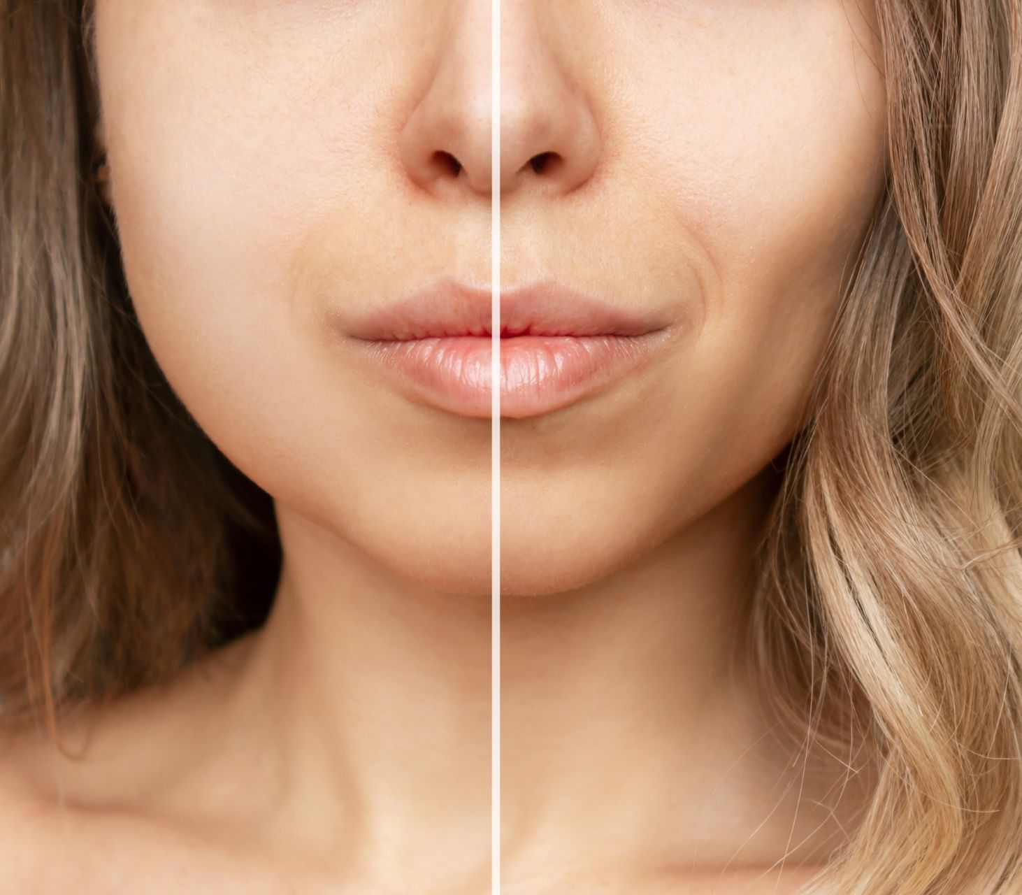 a before and after photo of a woman's face with buccal fat reduction