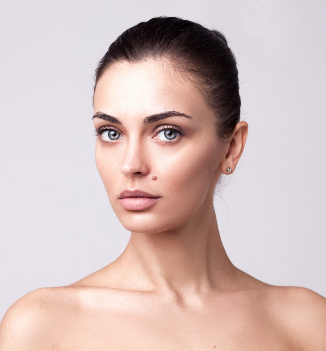 female model with large mole beauty mark on face