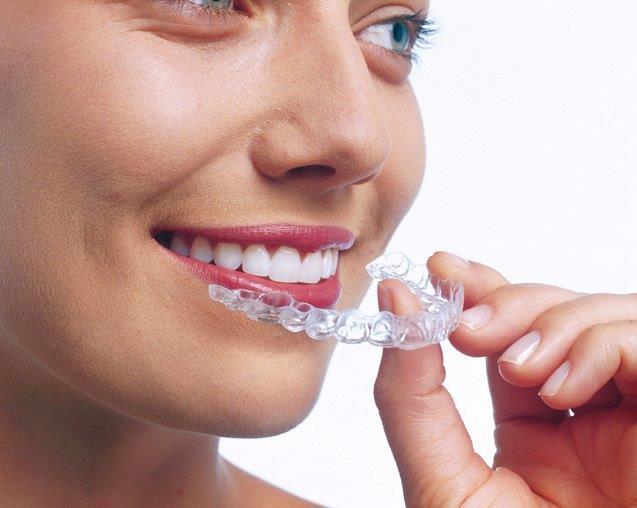 person som holder invisalign tannregulering foran munnen