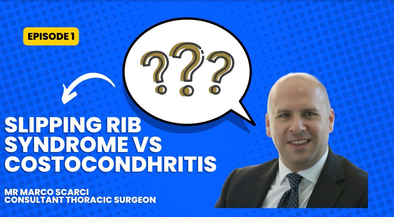 Slipping rib syndrome vs costochondritis are they the same thing?