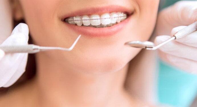 DRA. SUSANA PEDRERO DE LA CRUZ - LIMPIEZA DENTAL