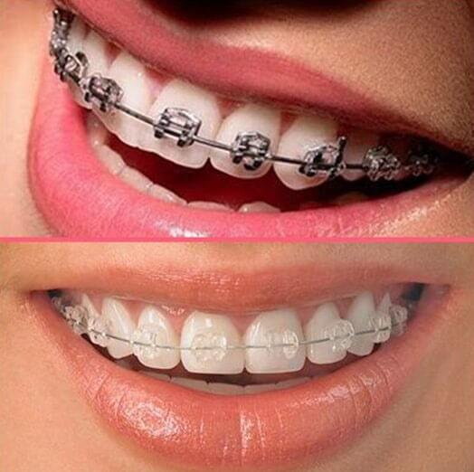 DRA. SUSANA PEDRERO DE LA CRUZ - ORTODONCIA