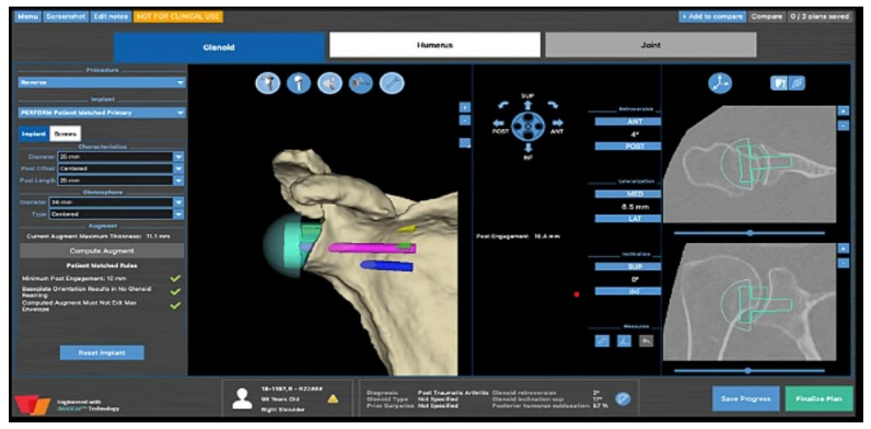Surgery Outline | AZ Ortho