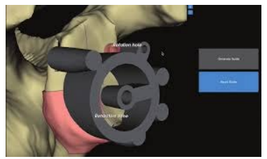 Surgery Approach | AZ Ortho