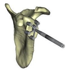 Mock up | AZ Ortho