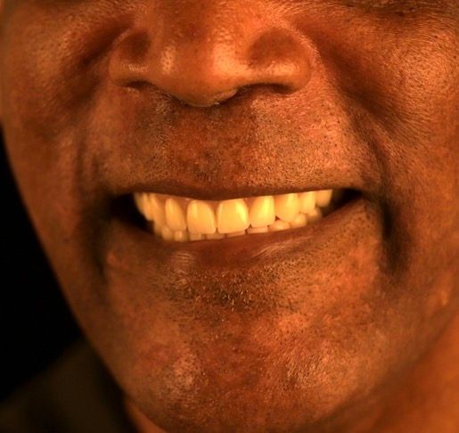 Close-up of teeth. The front teeth are light-colored and appear to be well-maintained, with a pink gum line.