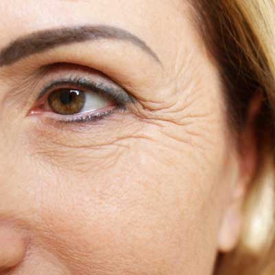 Best facial treatments for wrinkles in London