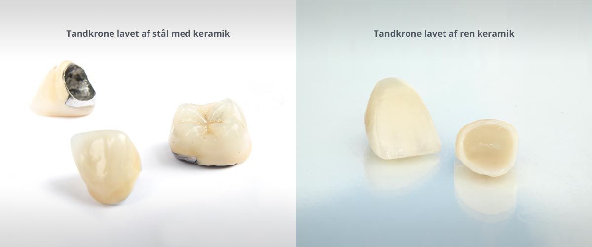 Et billede af en tand med krone og et billede af en tand uden krone