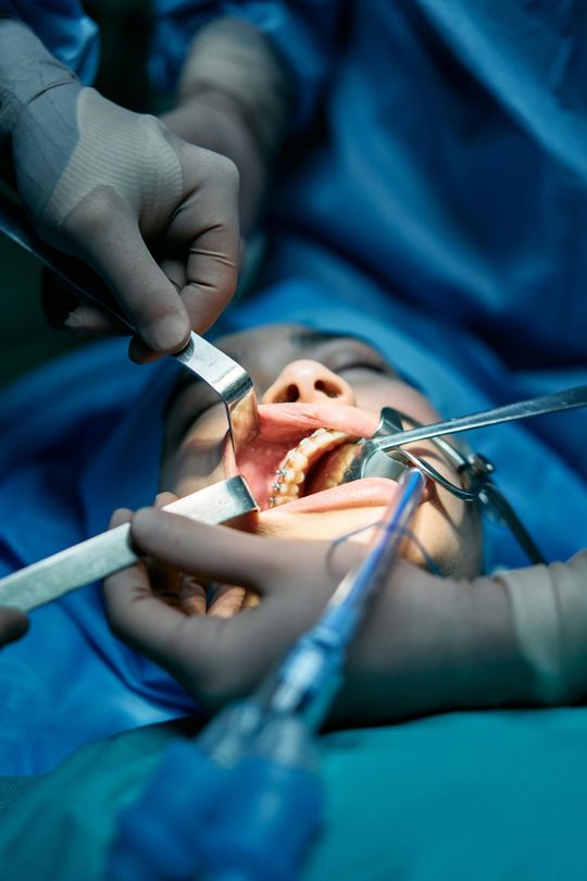 anesthesia provider, open mouth anesthesia 