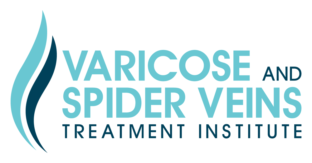 Tracy Varicose Vein Treatment // East Bay Vein Specialists