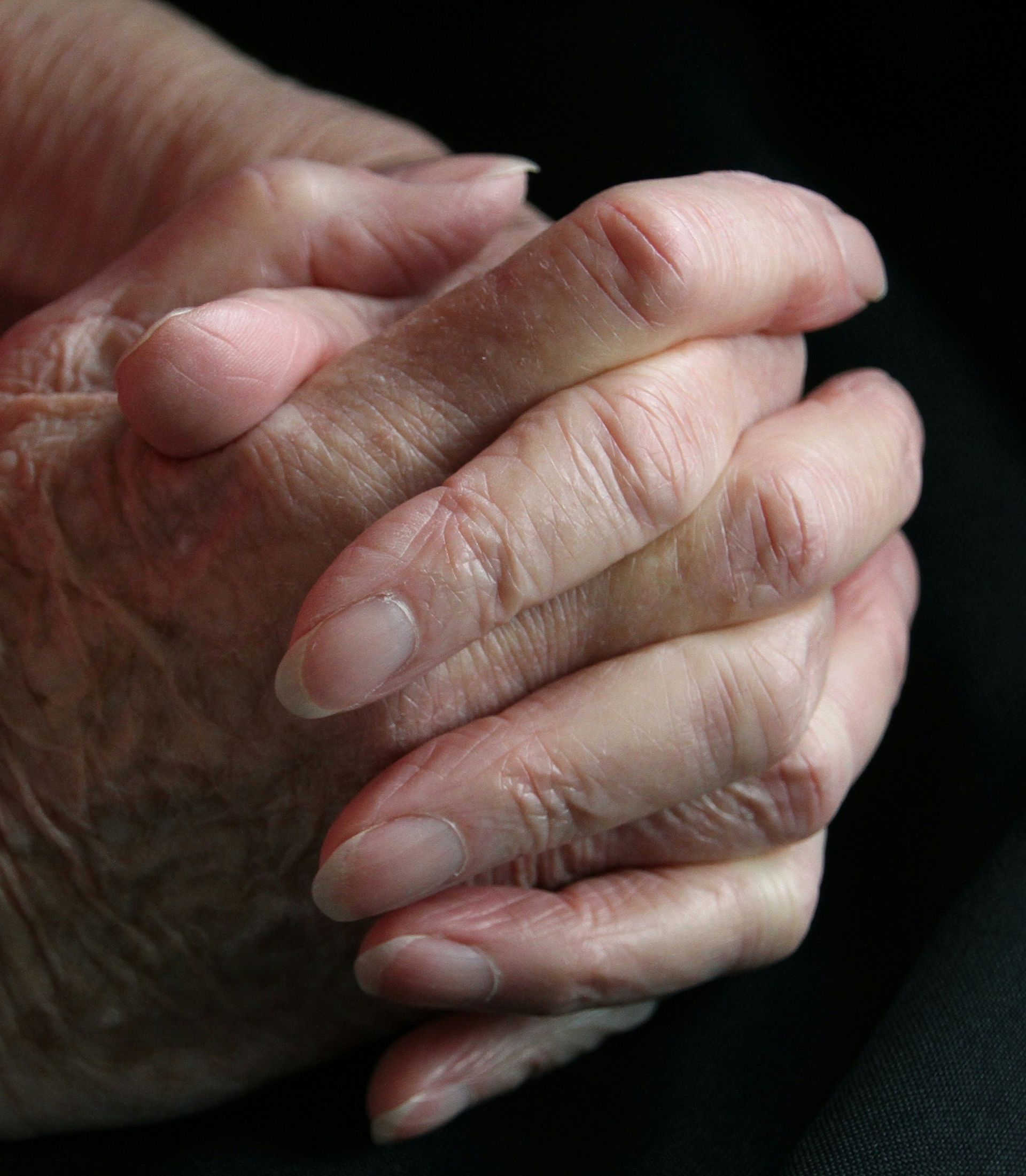 Close-up of an elderly person's hands, clasped together. Wrinkled skin, pale pink tones, and long nails are visible.