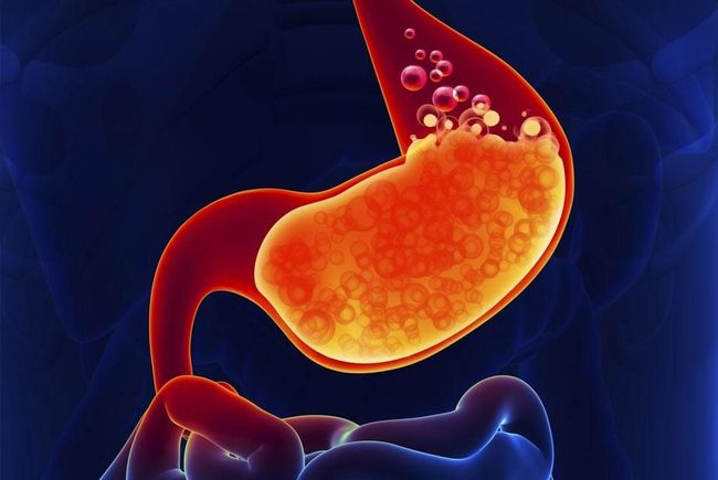 Diagrama de un estómago, lleno de contenido de color naranja y burbujas, sobre un fondo azul.