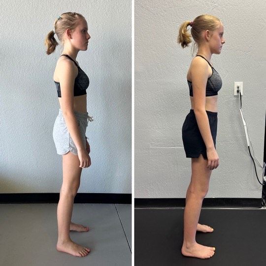 Scoliotic Posture Improvement