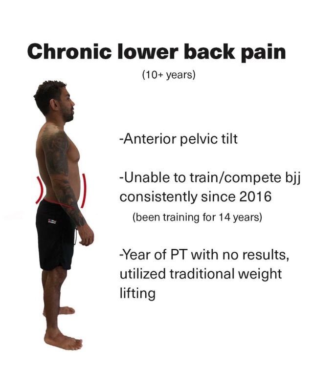 Chronic lower back pain