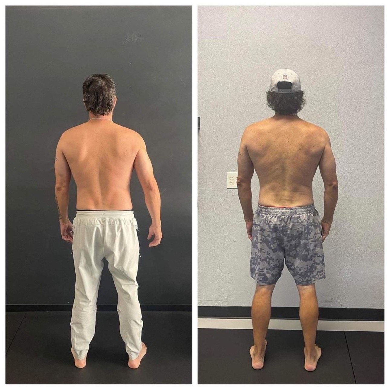 Back pain/scap wing/body fat reduction