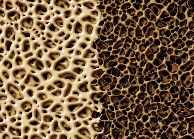 Composición para mostrar estructuras de hueso con y sin osteoporosis