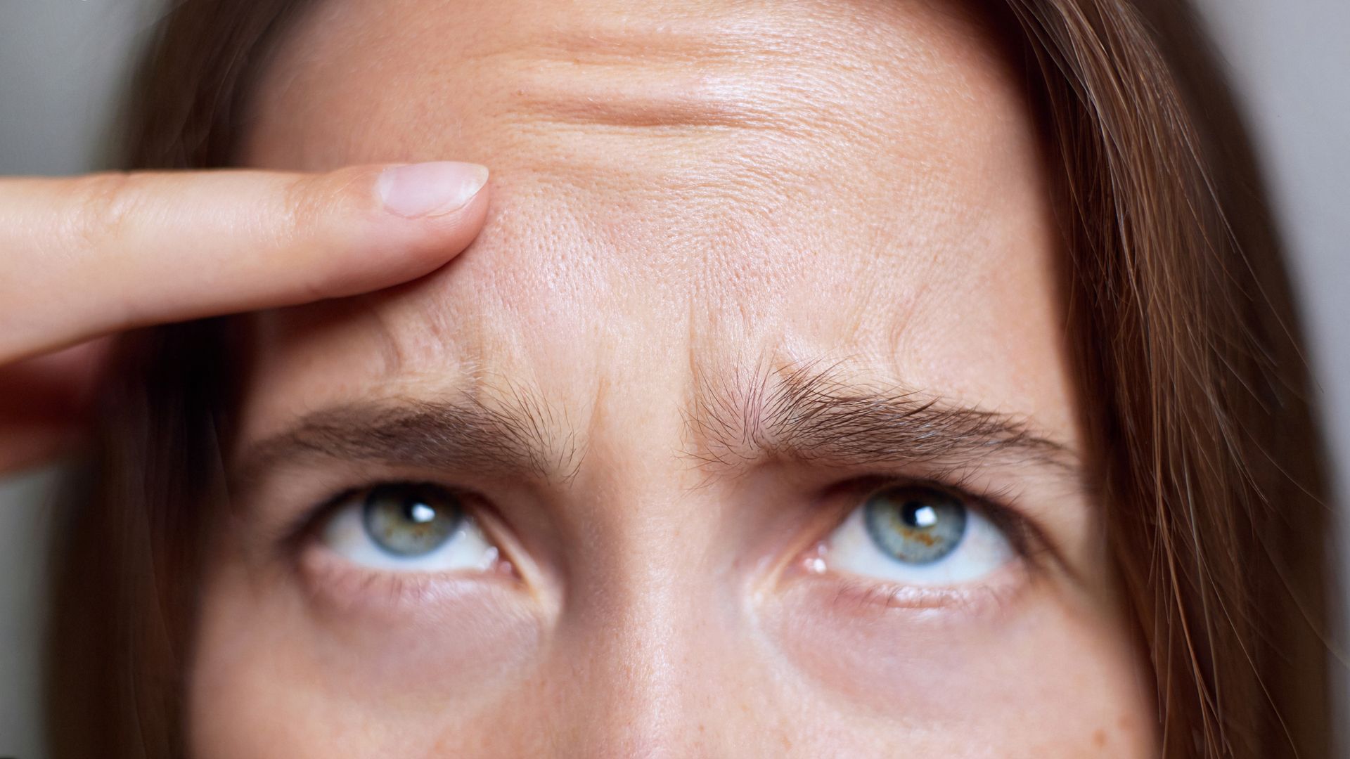 Woman examining forehead wrinkles, showcasing the need for frown Botox treatment for smooth skin.