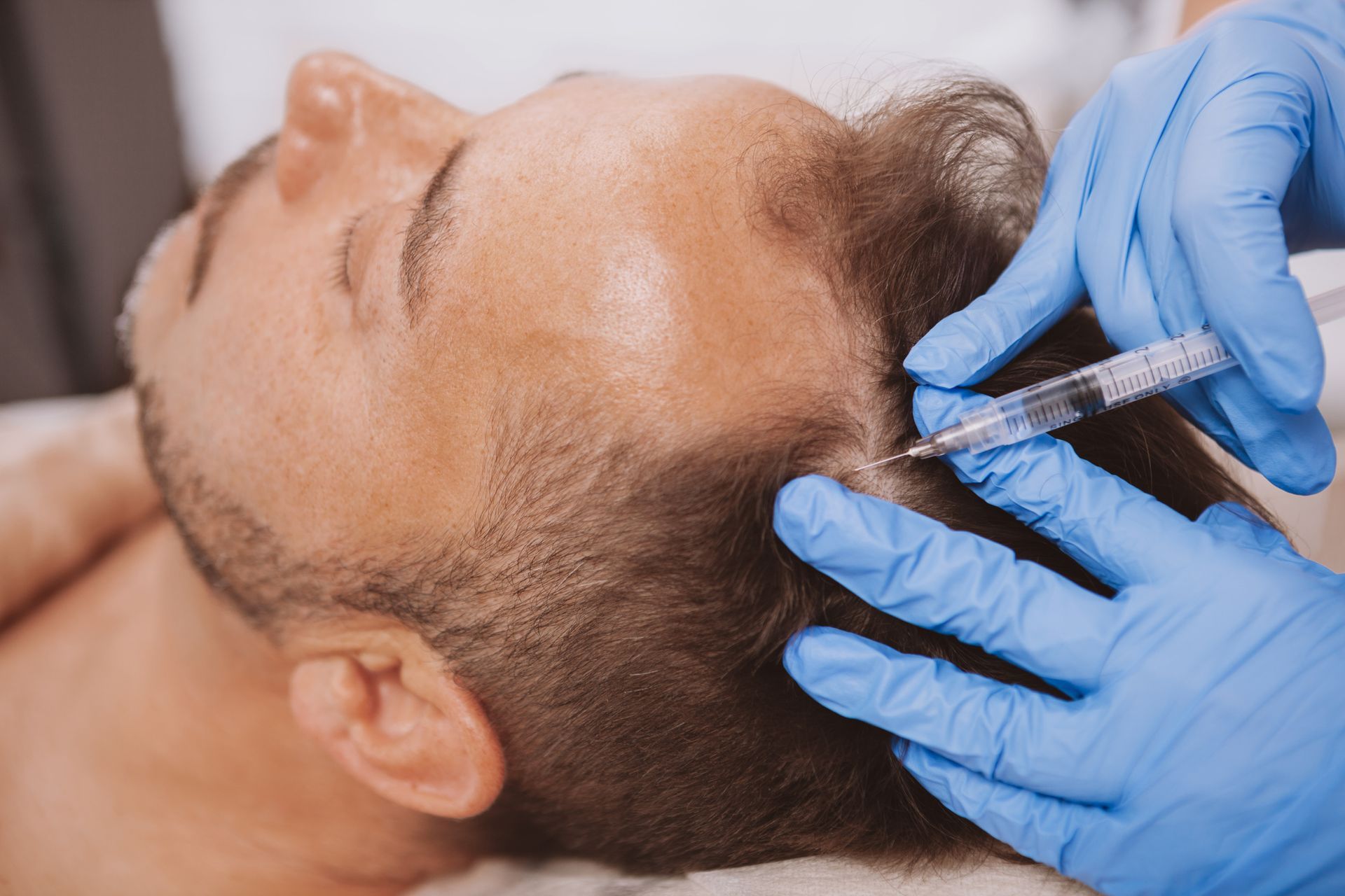 Man receiving injection in his scalp. Blue-gloved hands, sterile needle, light skin, focused treatment.