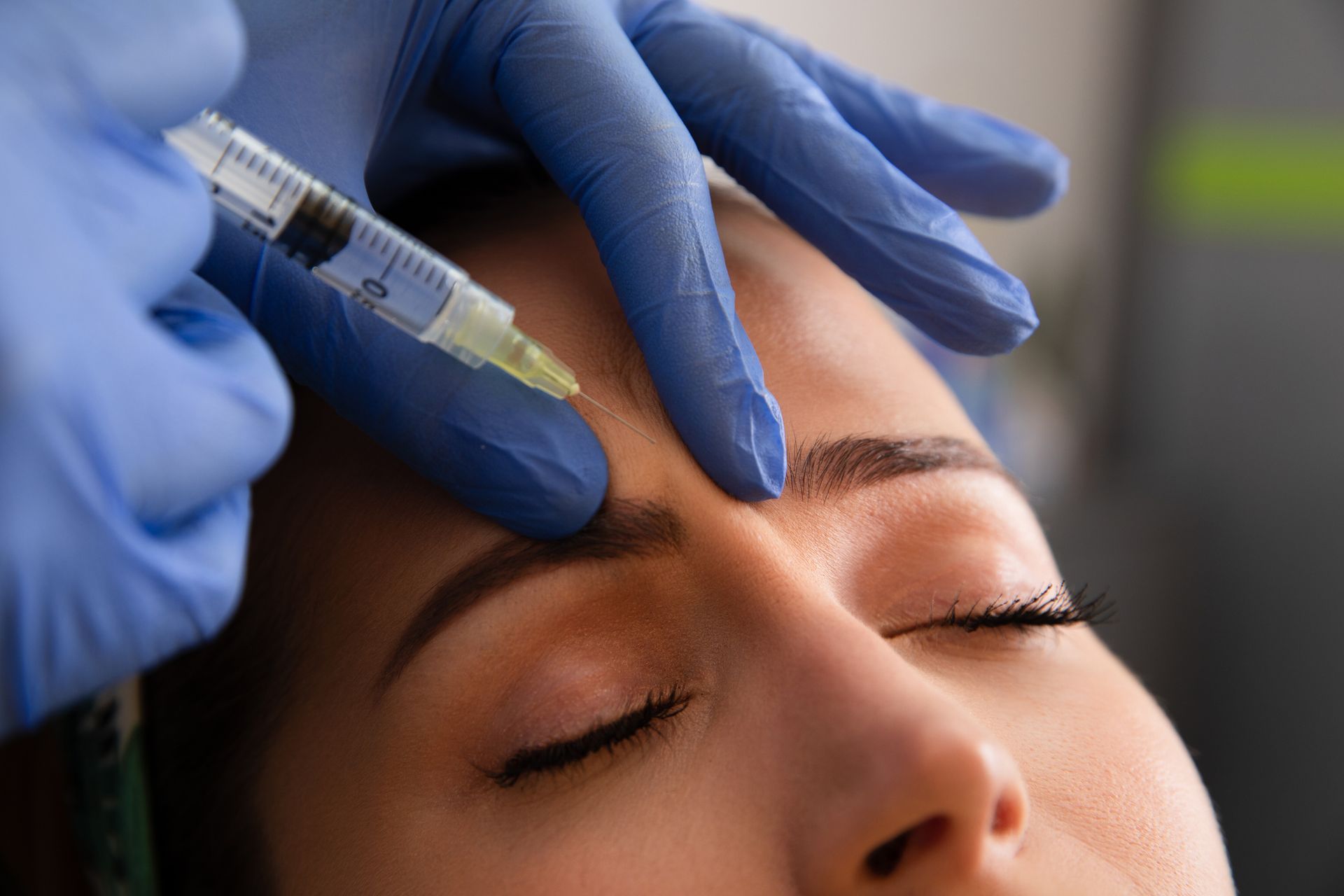 A person receiving a facial injection in the forehead. A gloved hand holds a syringe.