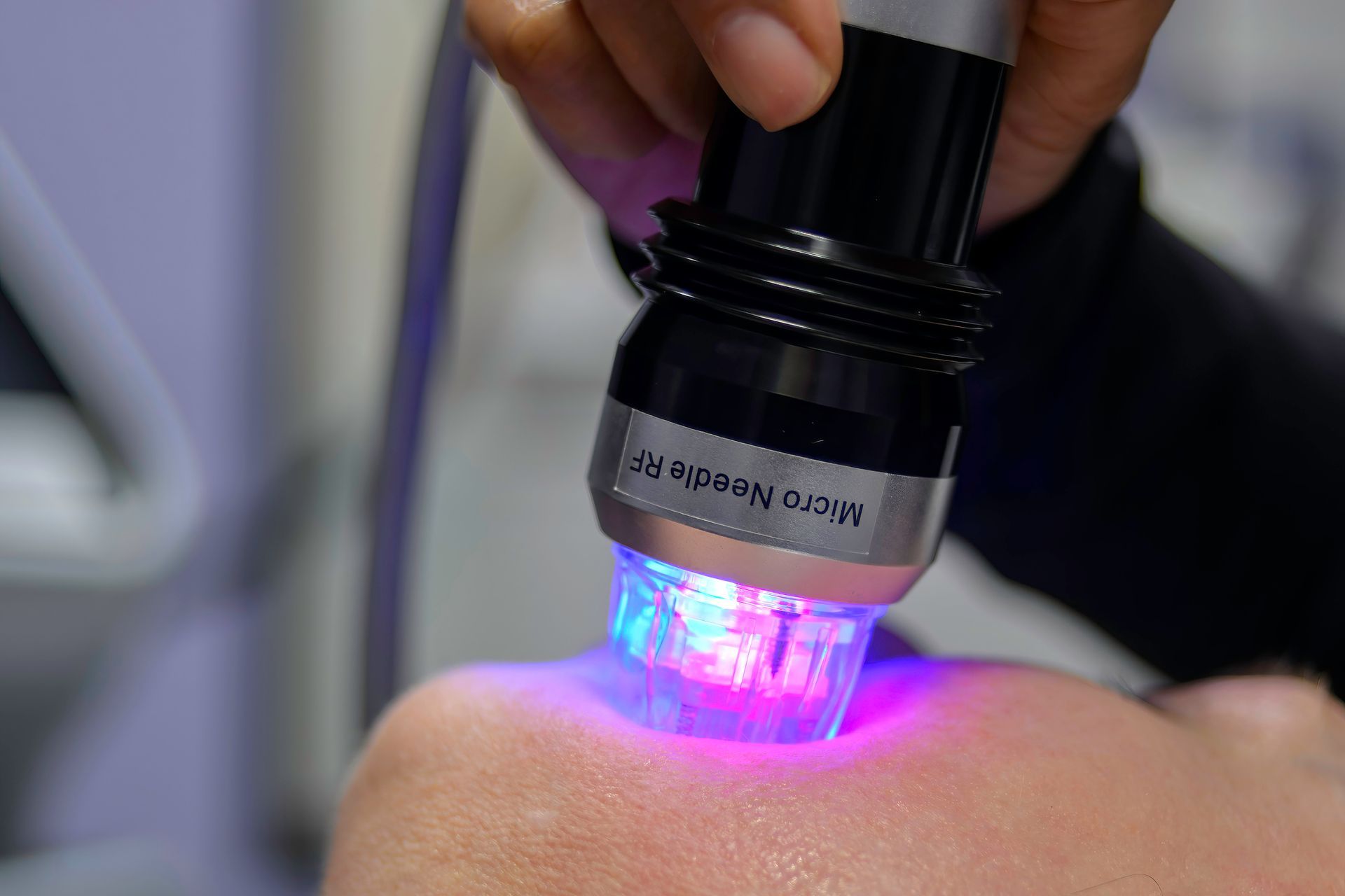 Person receiving micro-needling facial treatment with a glowing blue and purple device.