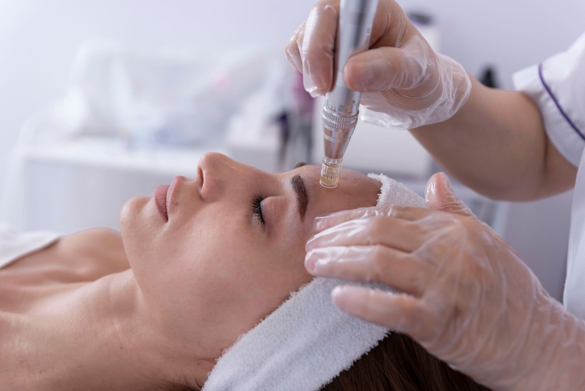 Woman receiving microneedling treatment on her forehead; esthetician's hands with gloves, light room.