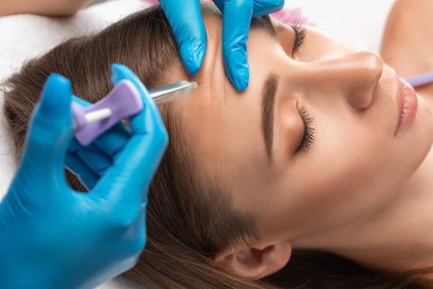 Woman receiving Botox injection in forehead, lying down with eyes closed. Blue gloves, light setting.