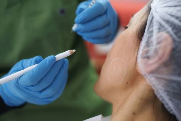 Person receiving cosmetic injections; doctor marking face with pencil, holding a syringe.