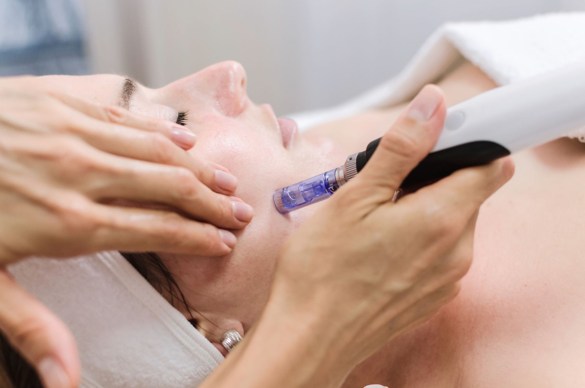 Woman receiving microneedling facial treatment, with a technician using a handheld device on her cheek.
