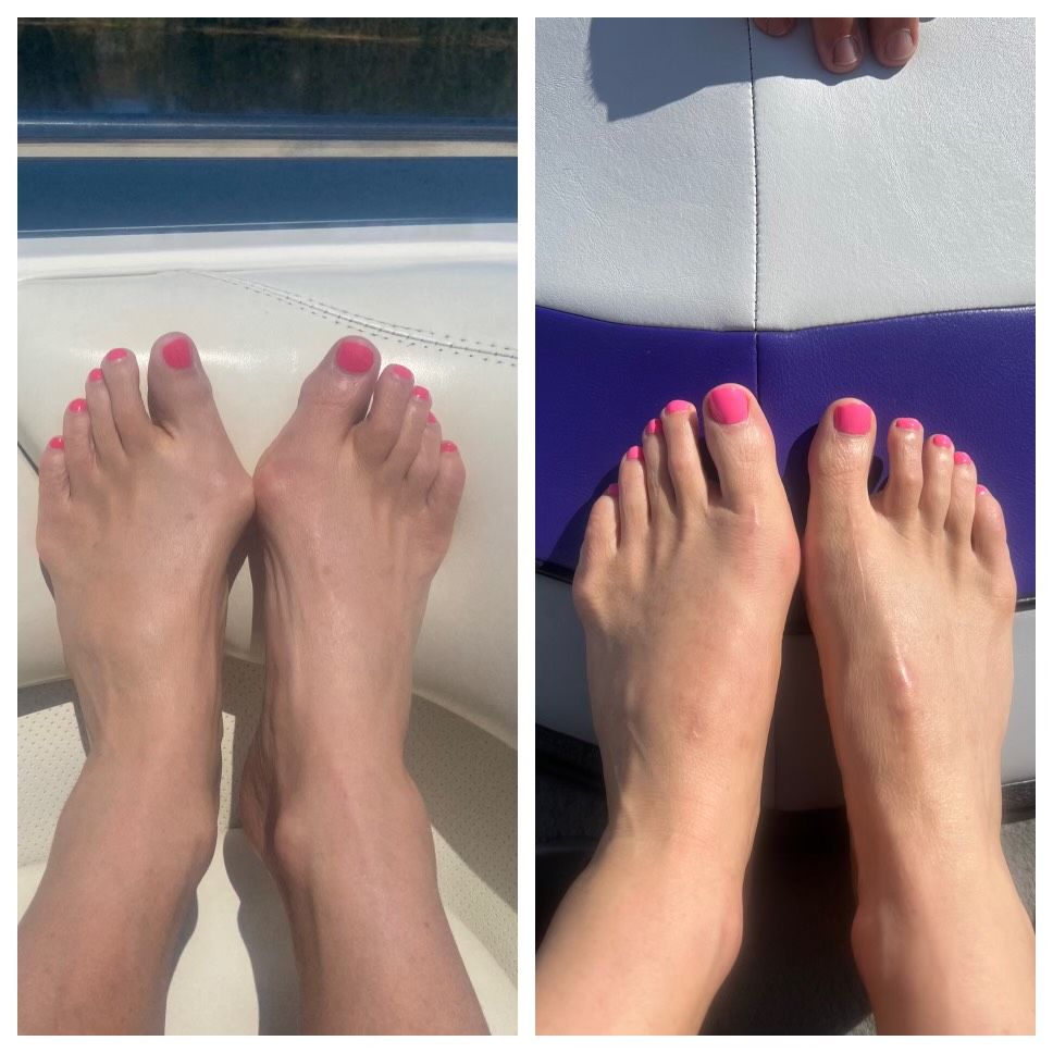 Two pictures of a woman 's feet with pink nail polish.
