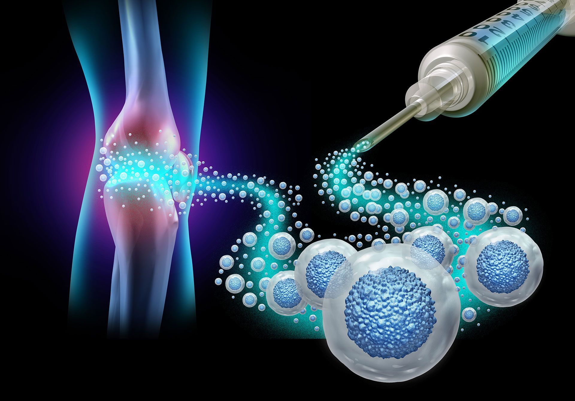 Regenerative Medicine and Mesenchymal Stem Cells injected for Knee joint pain to regenerate tissue repair as a cell therapy medical illustration close up macro view showing a sports injury.