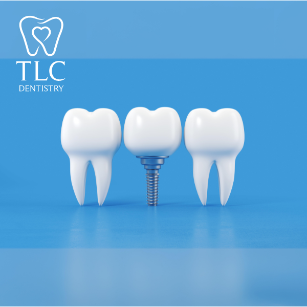 A woman with curly hair is laughing with her mouth open in a park.