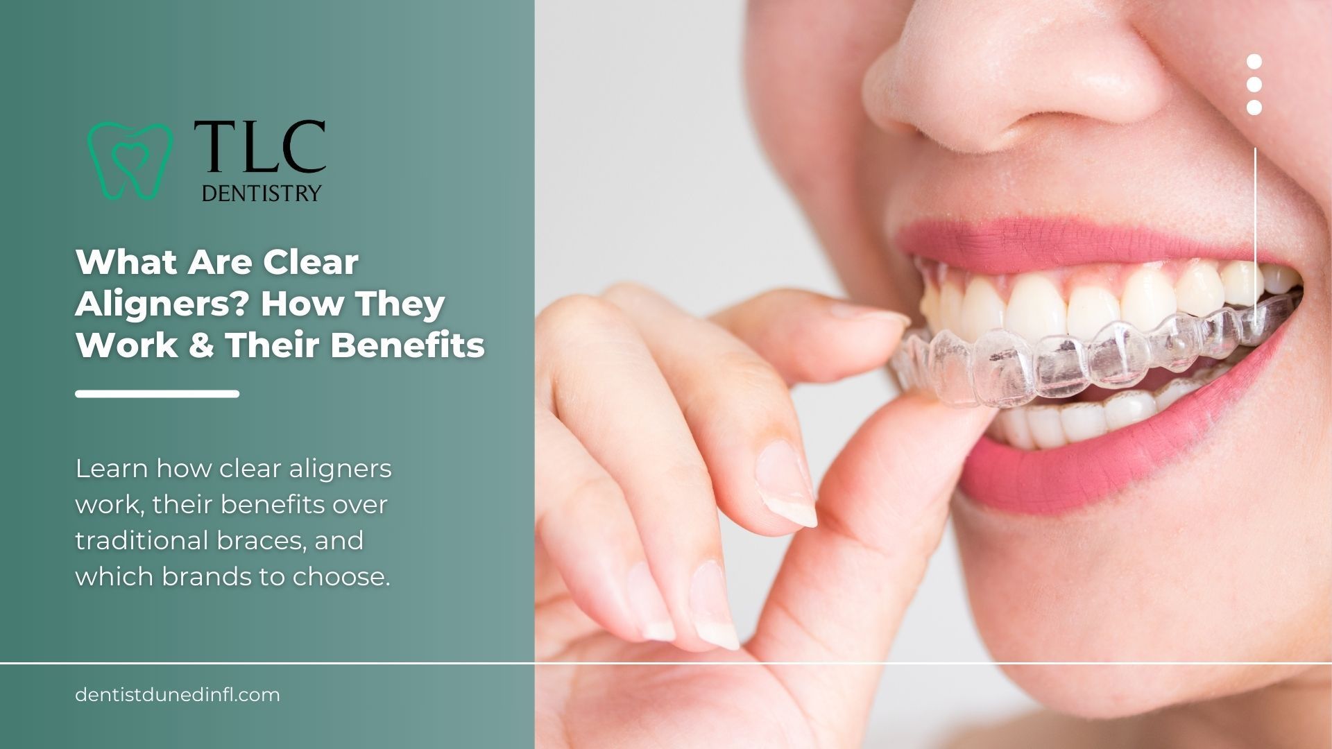 Woman putting in Invisalign tray