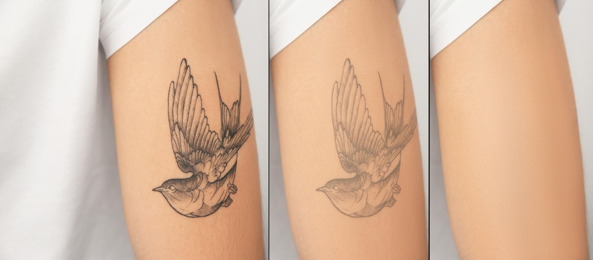 Tattoo Fading: Arm With A Bird Tattoo, Partially Faded, Then Fully Faded Skin  — Tattoo Inc Studio in Robina, QLD