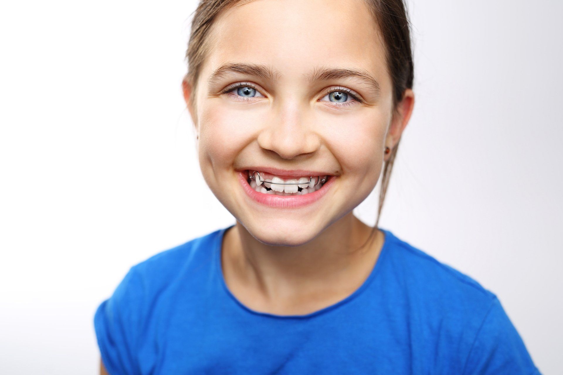 Zahnspange kann nachträglich versichert werden bei DentaHelp