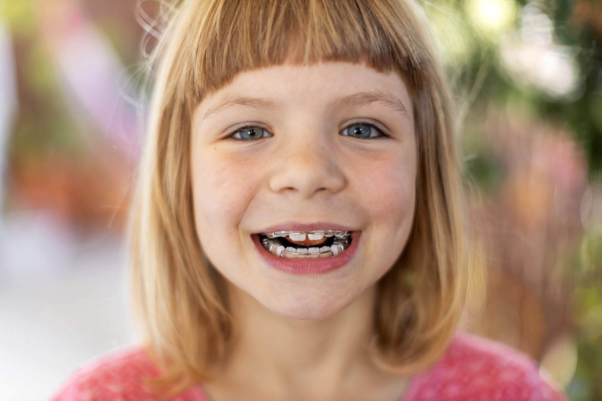 Zahnzusatzversicherung für Zahnspange nachträglich versichern