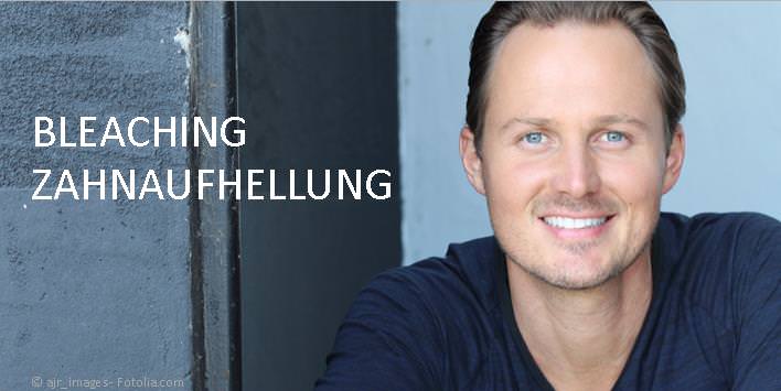 Bleaching (Zahnaufhellung): Weiße Zähne