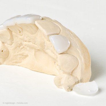 © mgbdesign - Fotolia.com