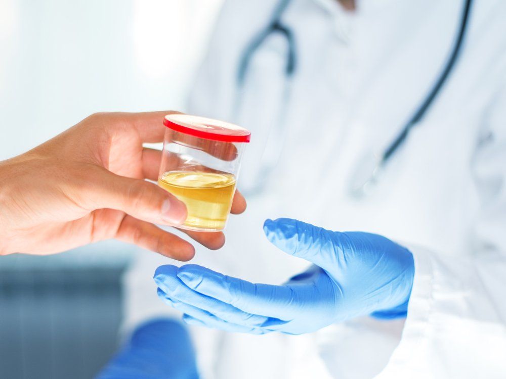 Urine Sample to A Doctor — North Port, FL — A-1 Fingerprinting and Drug Screening