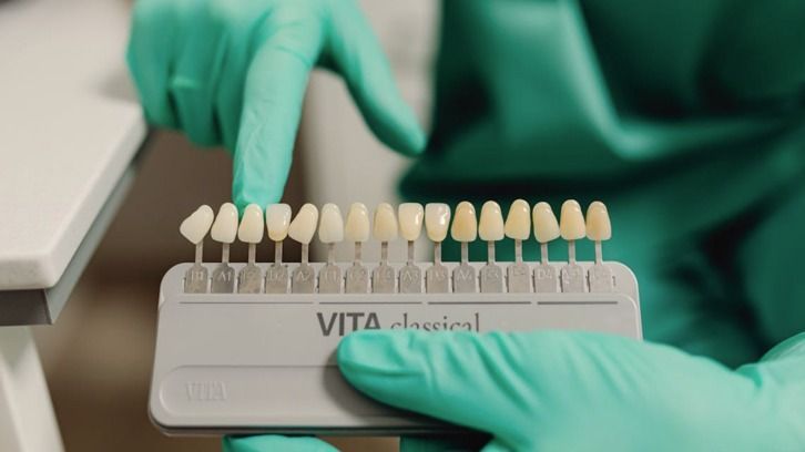 Una persona que lleva guantes verdes sostiene una tabla de colores de dientes.