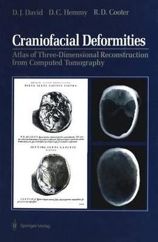 Craniofacial Deformities Book