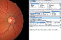 EMR Optometry Software