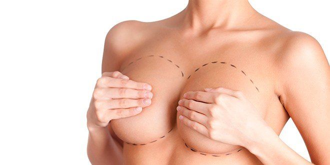 Tipos de implantes mamarios