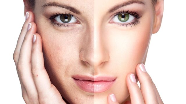 Rejuvenecimiento sin cirugía: Tratamientos para embellecer tu rostro