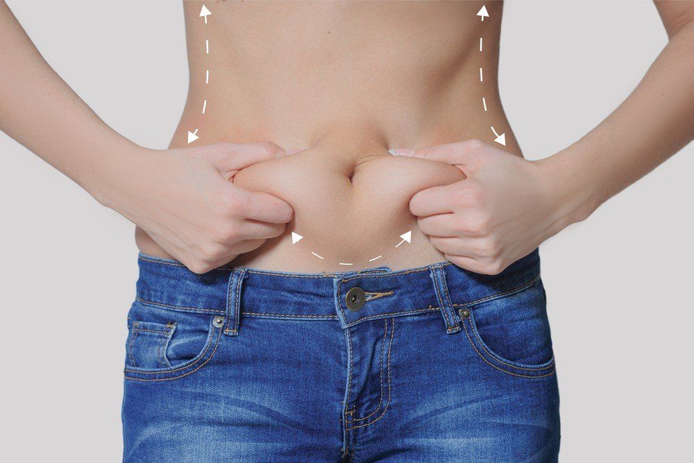 Abdominoplastia flor de lis: Tipos de técnicas